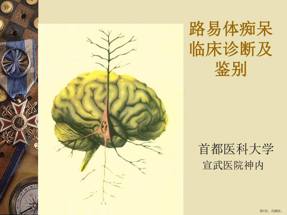 路易体痴呆临床诊断与鉴别讲解课件.ppt_第1页