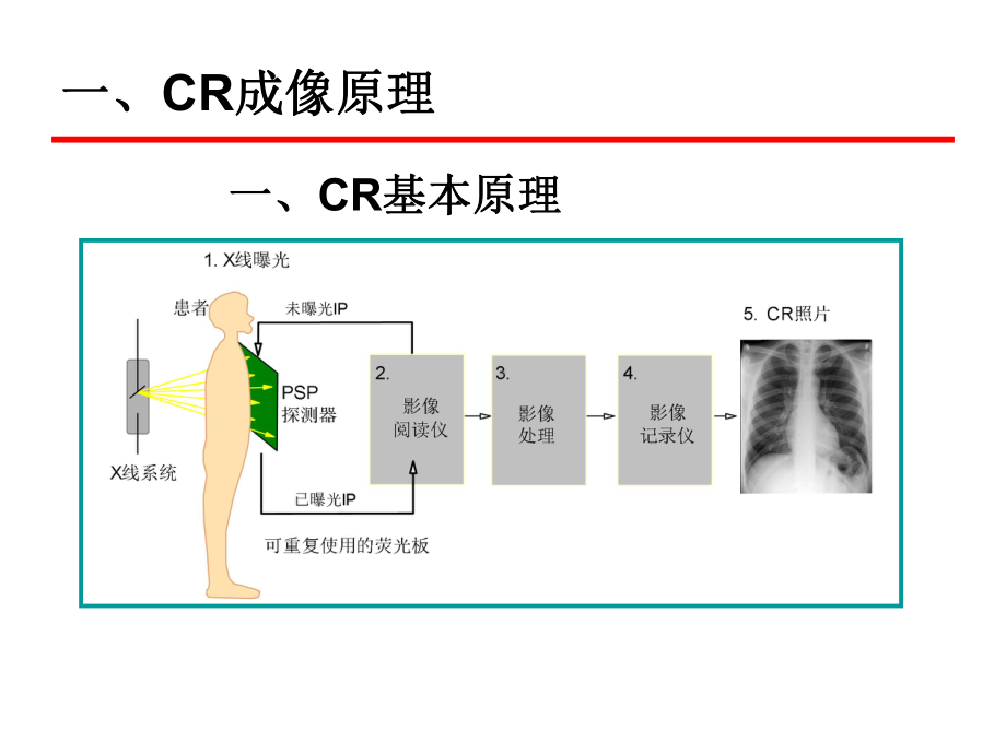 计算机X线摄像系统课件.ppt_第3页