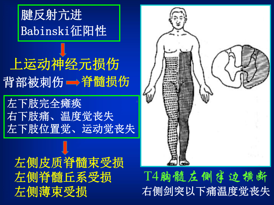 系统解剖学6周围神经课件.ppt_第3页