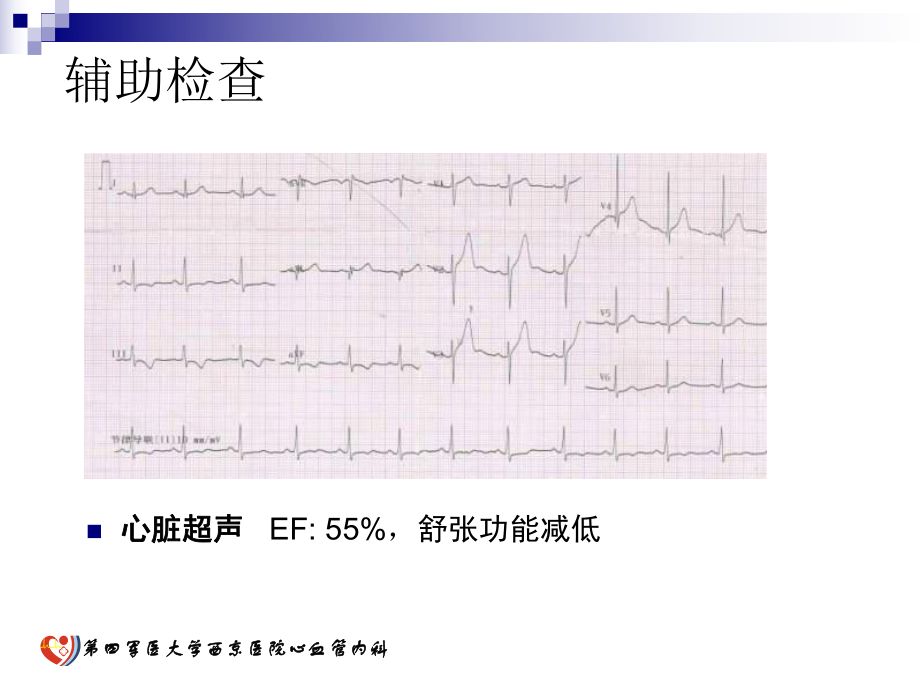 经桡动脉处理大血管小支架术后再狭窄课件.ppt_第3页