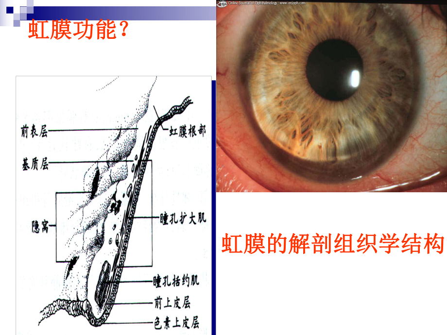 葡萄膜疾病解析课件.ppt_第3页