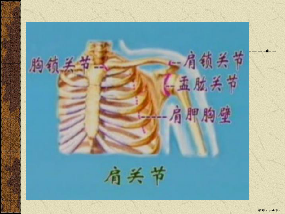 肩关节脱位课件(同名).ppt_第3页