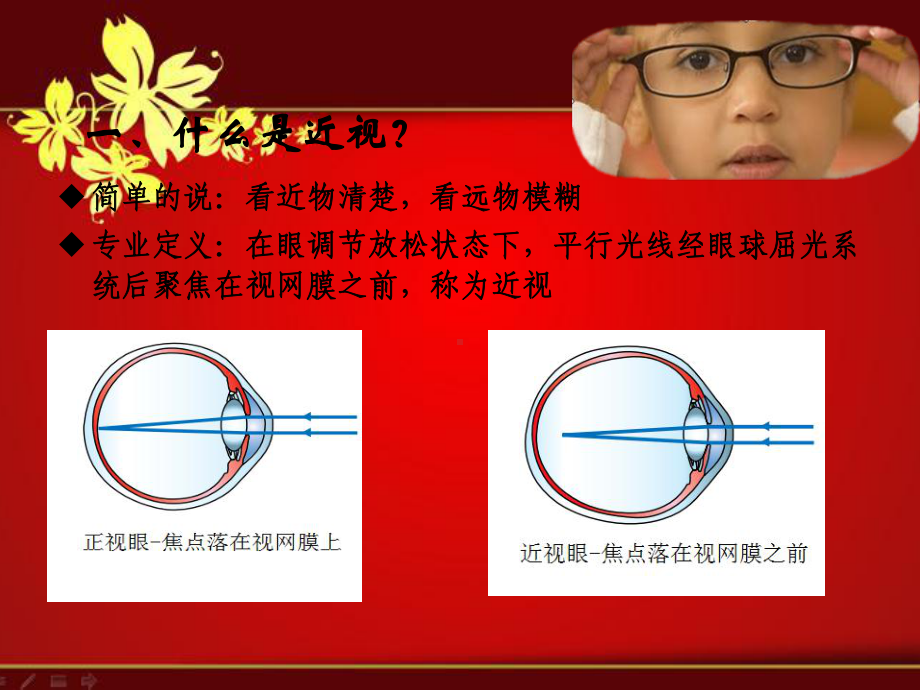 课程：第四讲近视中学课件.ppt_第2页