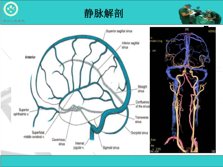 脑血管疾病CTA诊断课件.ppt_第2页