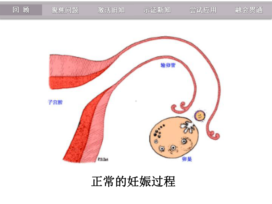 输卵管妊娠破裂出血的护理课件.ppt_第2页