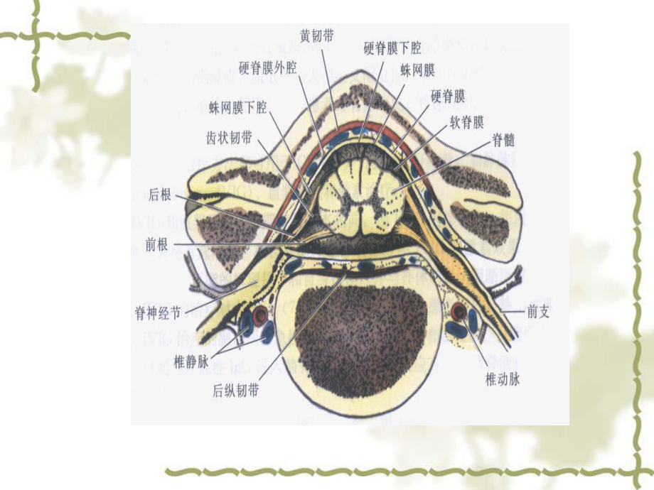 脊髓血管病（可编辑的）课件.ppt_第3页