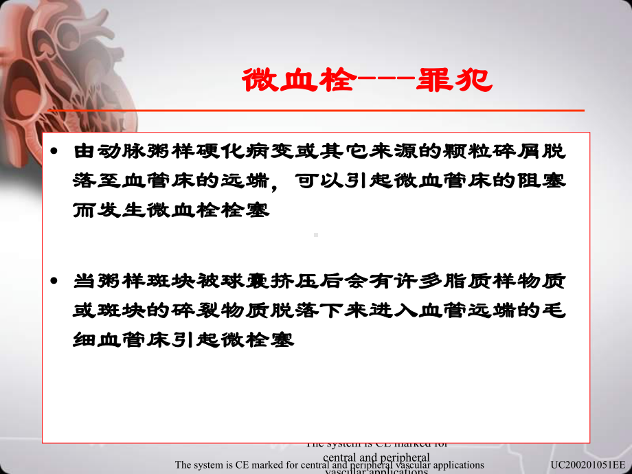 血管远端保护装置课件.ppt_第2页