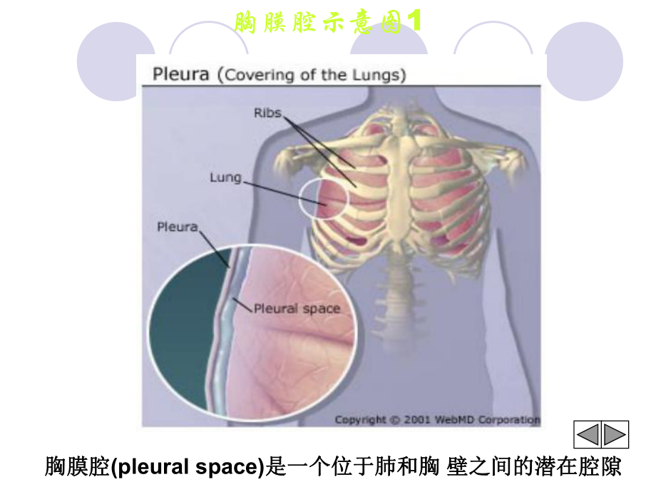 胸膜疾病胸腔积液相关介绍课件.ppt_第3页