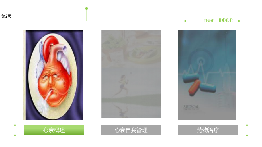 讲堂之心衰不可怕课件.ppt_第3页