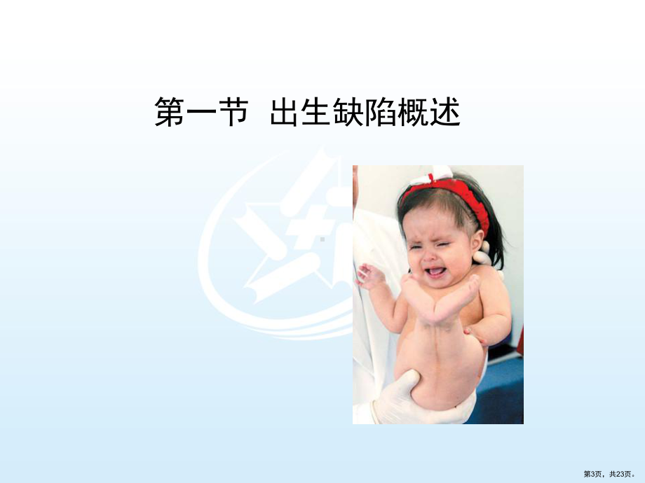 遗传与优生学基础第三章出生缺陷基础课件.ppt_第3页