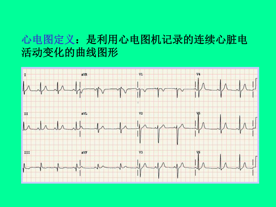 诊断学(实验)心电图教学课件.ppt_第3页