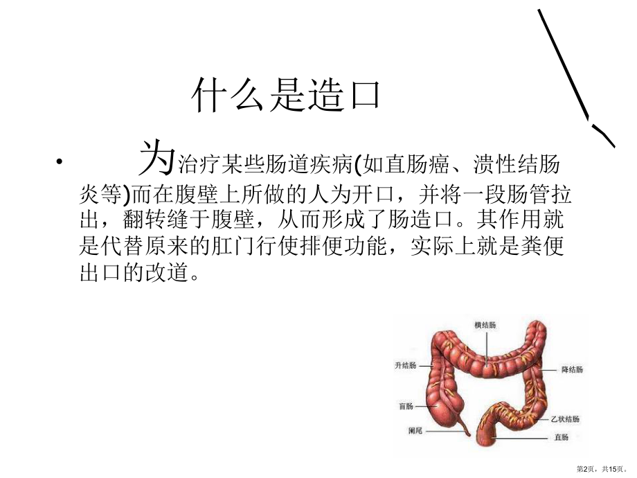 肠造口患者的生活指导课件.ppt_第2页