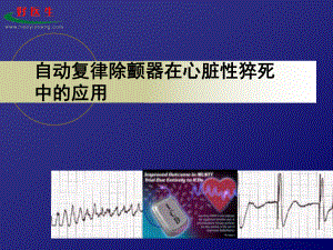 自动复律除颤器心脏性猝死中应用课件.ppt