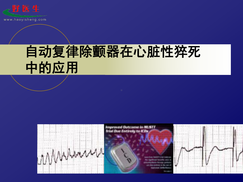 自动复律除颤器心脏性猝死中应用课件.ppt_第1页