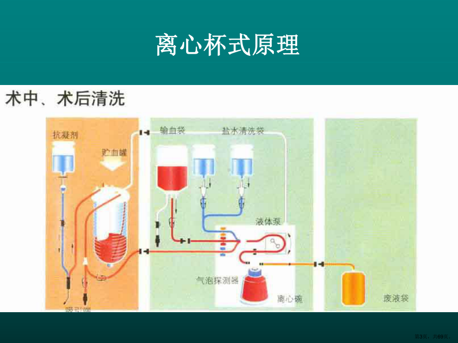 血液回收的临床应用进展课件.ppt_第3页