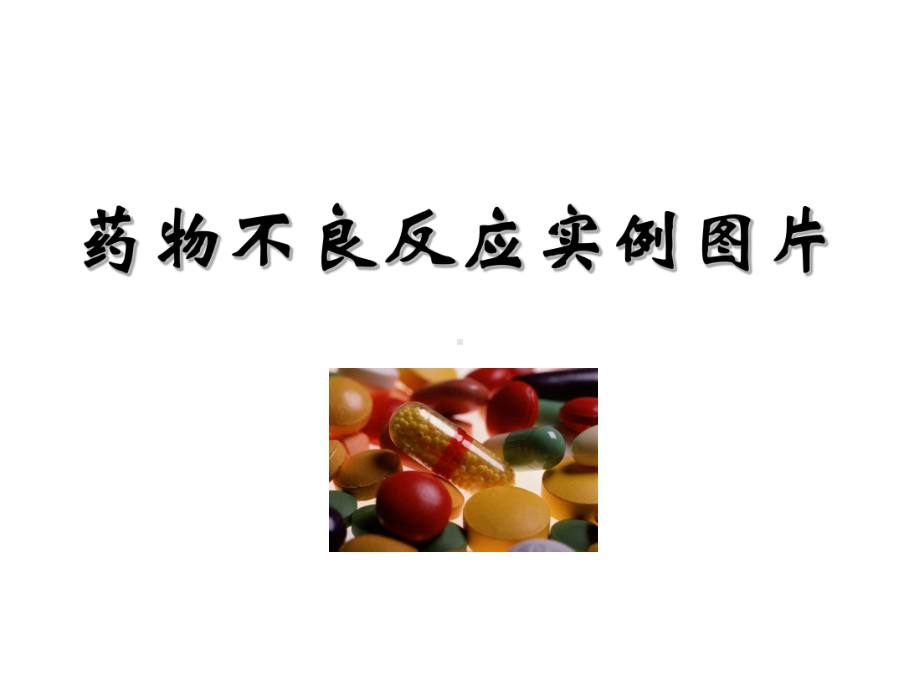 药物不良反应实例图片(研究生)(14)课件.ppt_第1页