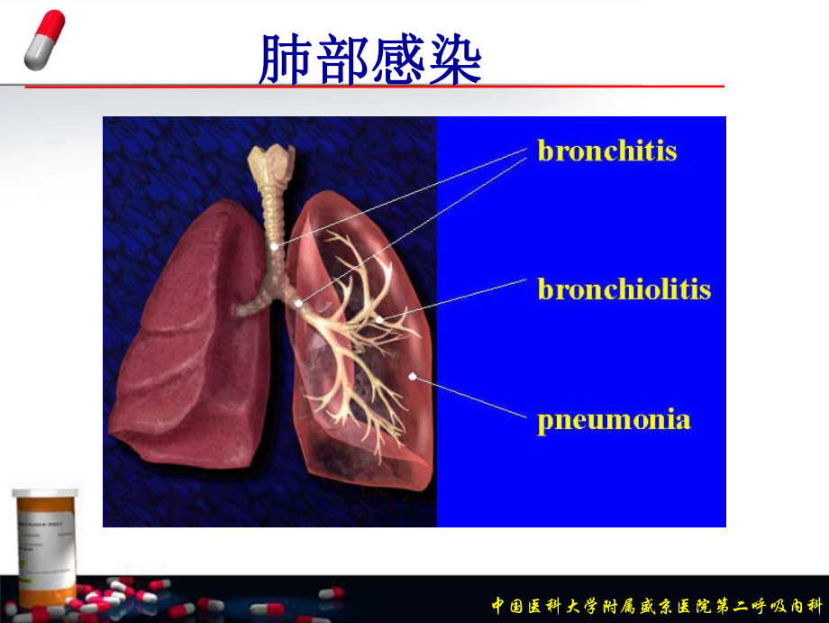 讲座：抗菌药的合理应用与感染防治课件.ppt_第2页