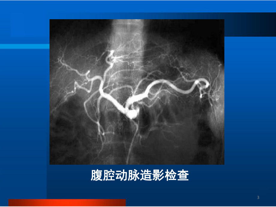 肝胆胰脾正常及异常影像表现课件.pptx_第3页