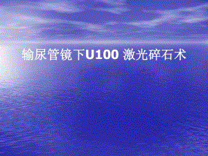 输尿管镜下U100激光碎课件.ppt