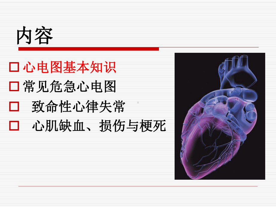 致命性心电图的识别新课件.ppt_第2页