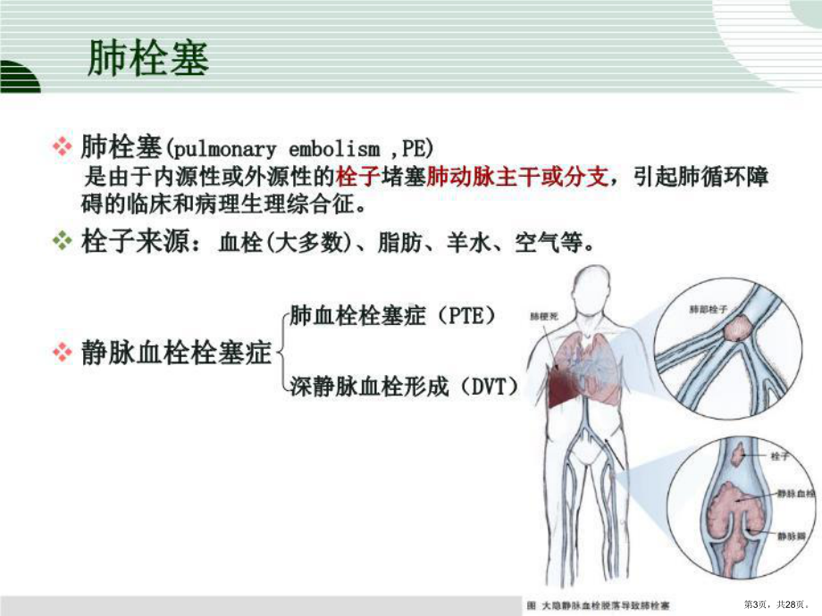 肺栓塞溶栓的护理课件2.ppt_第3页