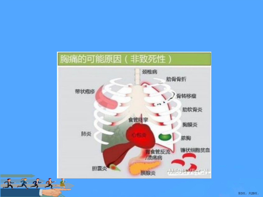 诊断学胸腹头痛课件.ppt_第3页