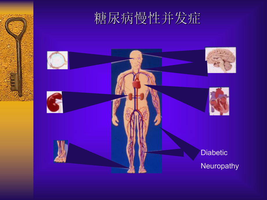 糖尿病并发症2课件.ppt_第3页