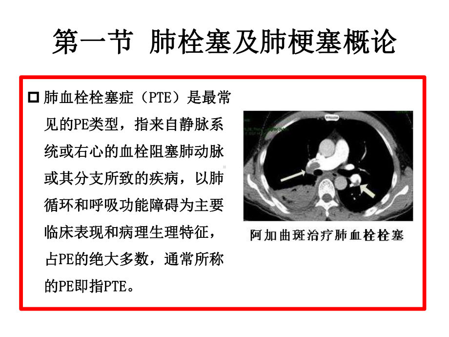 肺栓塞与肺梗塞CT诊断课件.ppt_第3页