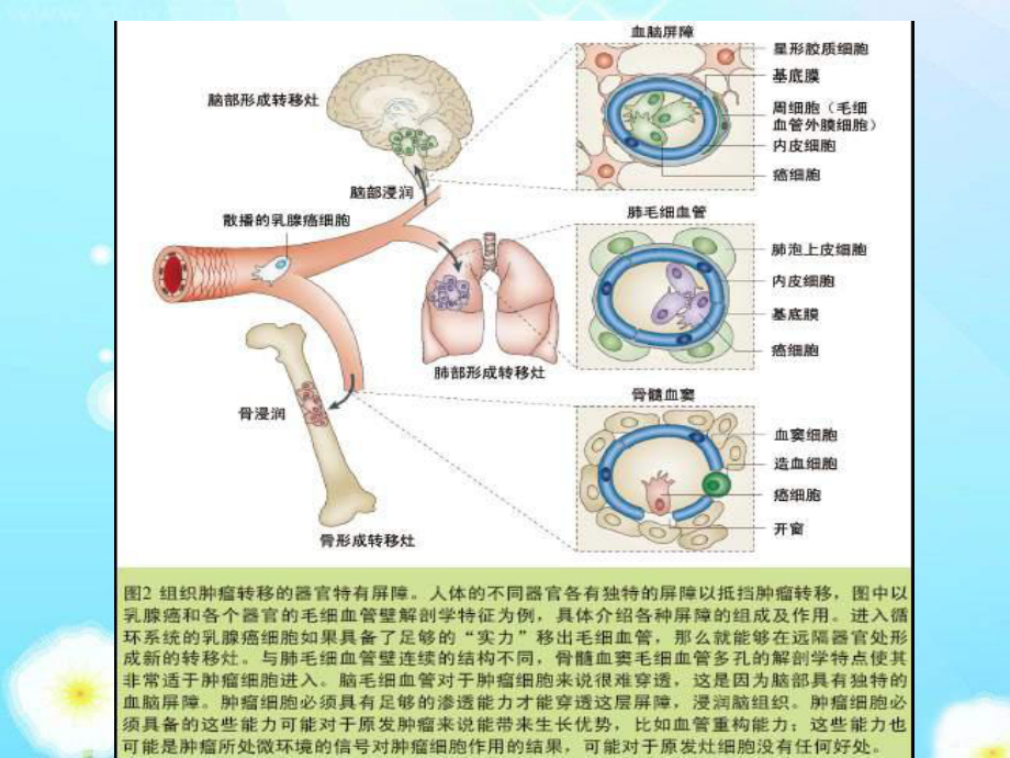 肿瘤转移的发生和其它课件.ppt_第3页