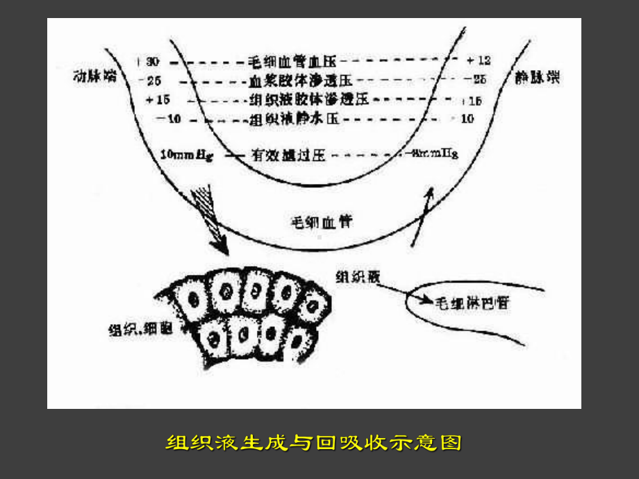 诊断学症状篇水肿课件.pptx_第2页