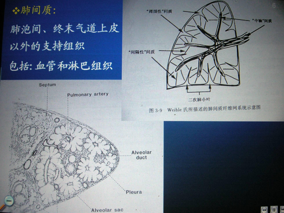 结缔组织病相关肺间质病变课件.ppt_第3页