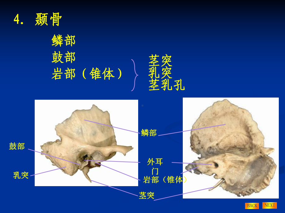 耳颞骨病变的CT诊断鼻窦课件.ppt_第3页