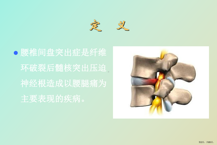 （教学课件）腰椎间盘突出症的诊断和治疗.ppt_第2页