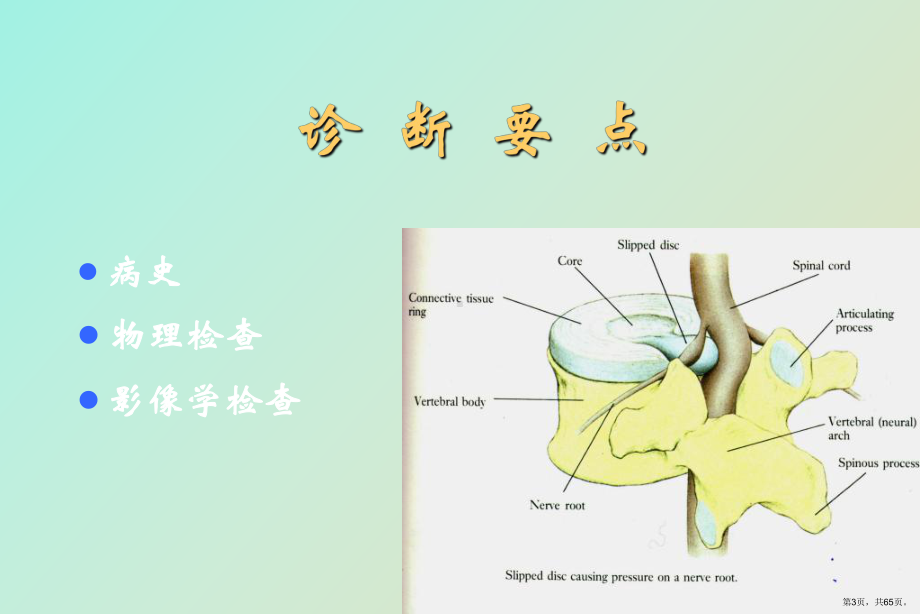 （教学课件）腰椎间盘突出症的诊断和治疗.ppt_第3页