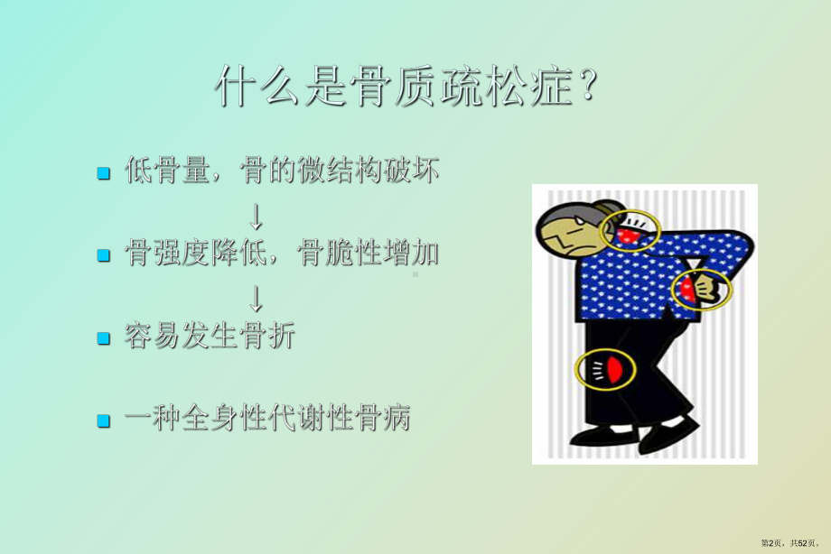 （教学课件）骨质疏松症防治.ppt_第2页