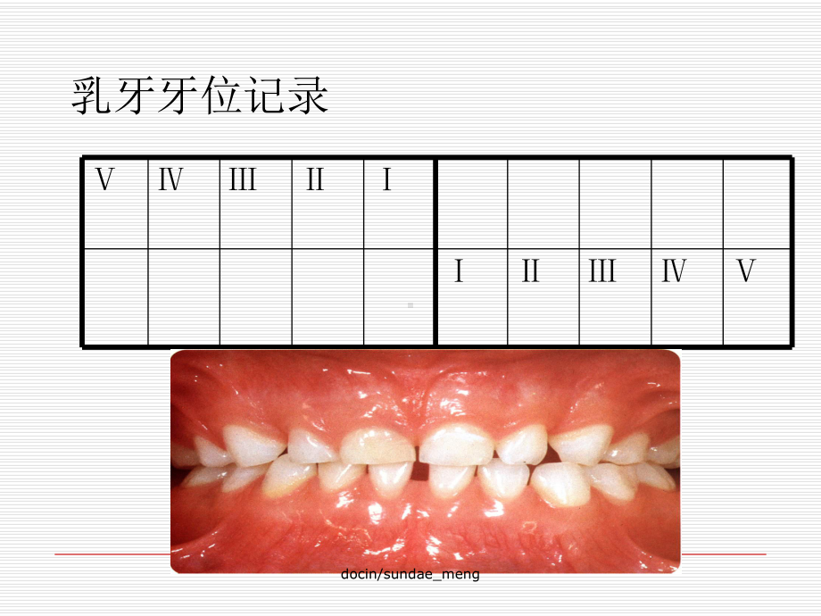 （教学课件）儿童口腔保健.ppt_第3页