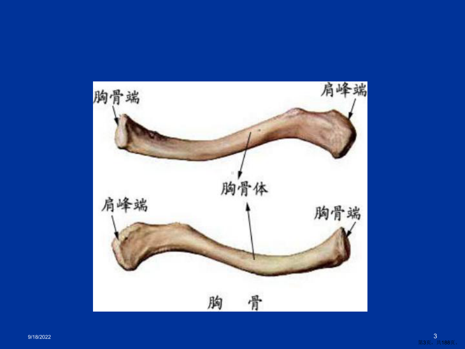 上肢骨关节损伤教学课件.ppt_第3页