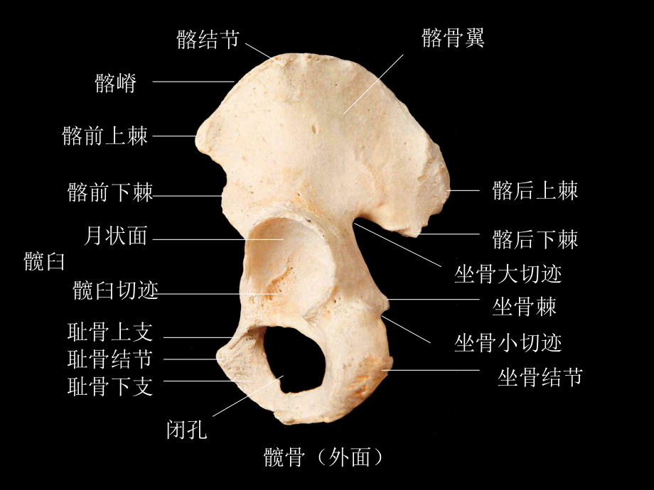 下肢骨及其连结教学课件.ppt_第3页