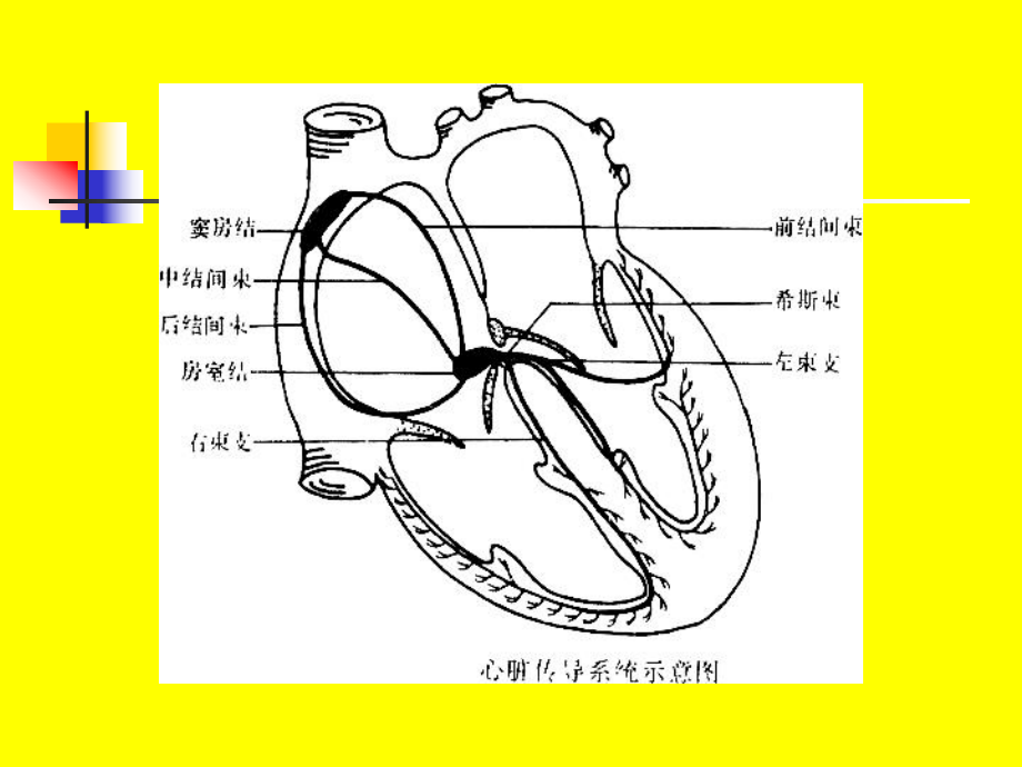 三篇心律失常-2课件.ppt_第3页