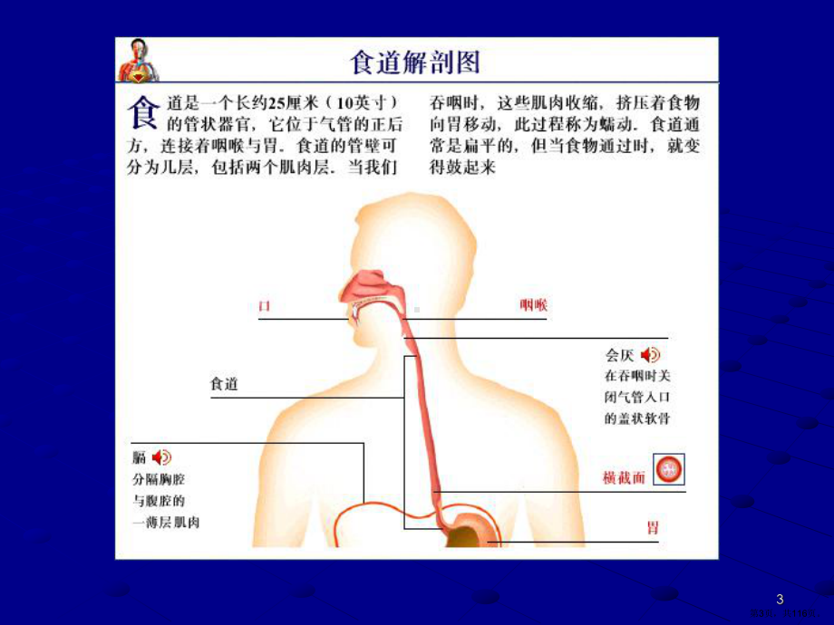 上消化道出血第八版教学课件.ppt_第3页