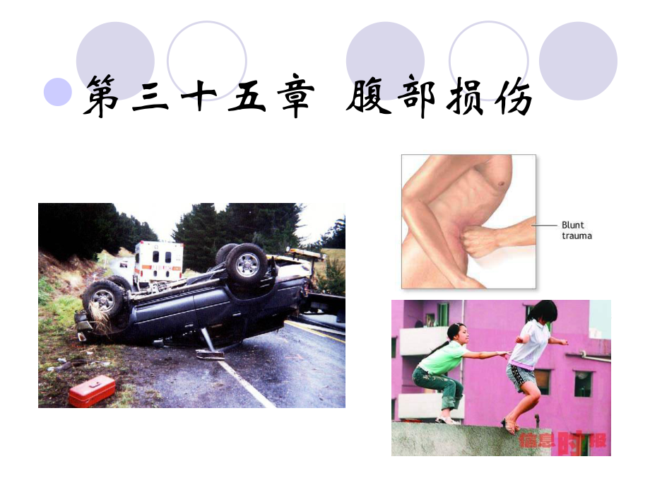 三十五章腹部损伤课件.ppt_第1页