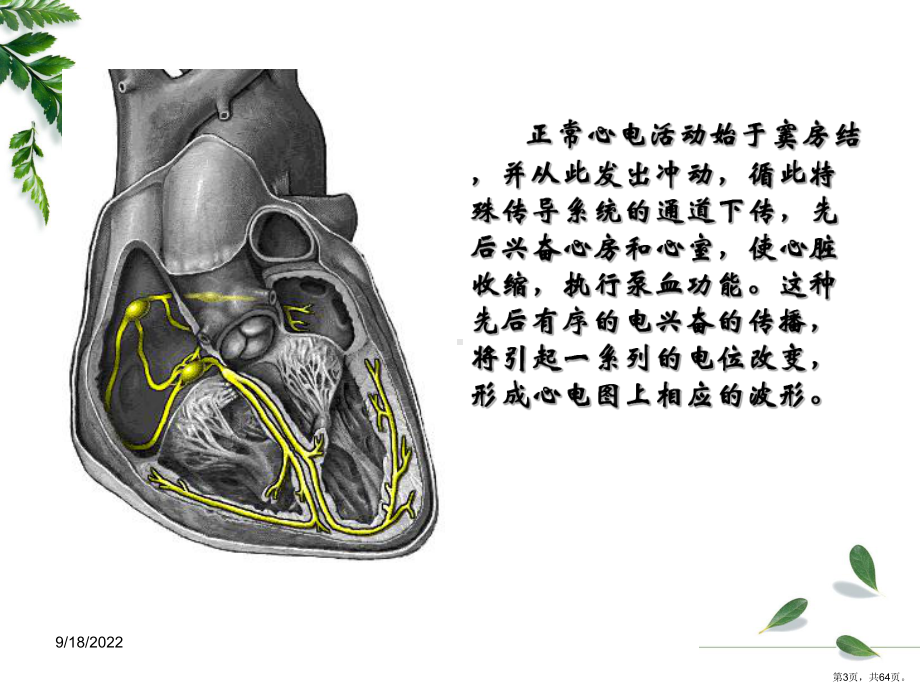 专科护士讲课心电图基础教学课件.ppt_第3页