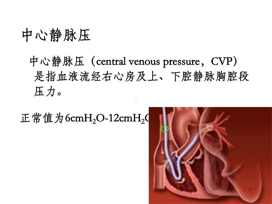 中心静脉压CVP监测课件.ppt_第3页