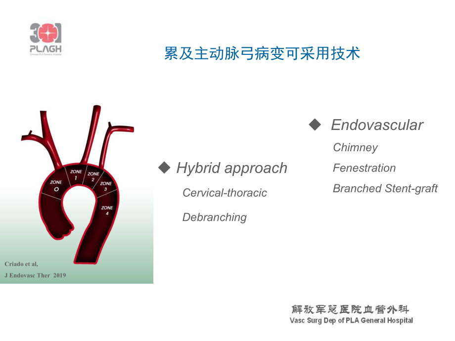 主动脉弓复杂病变HybridChimneyorelse医学课件.ppt_第2页