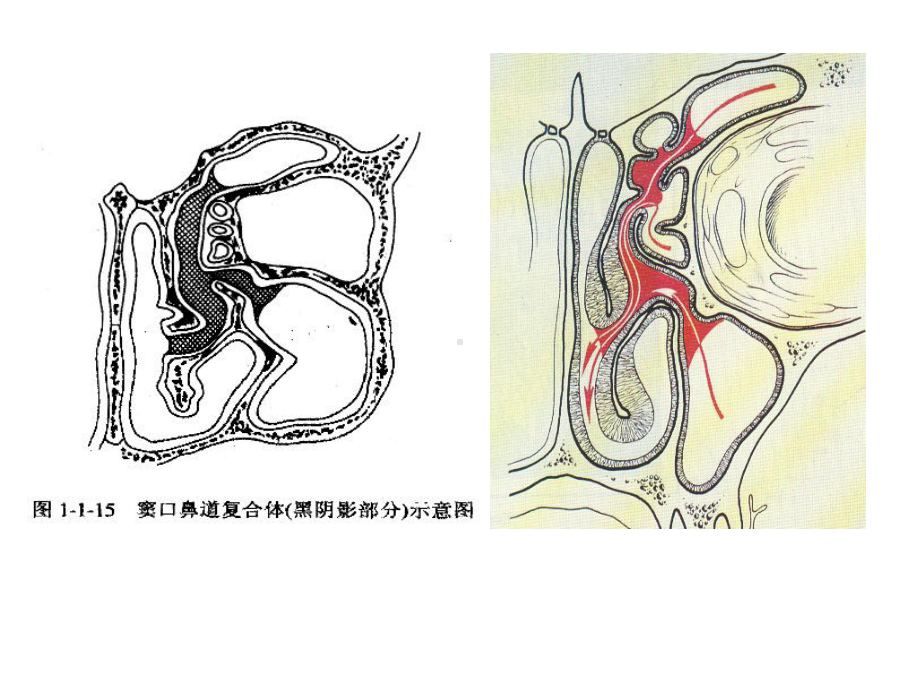 2021年窦口鼻道复合体实用课件.ppt_第2页