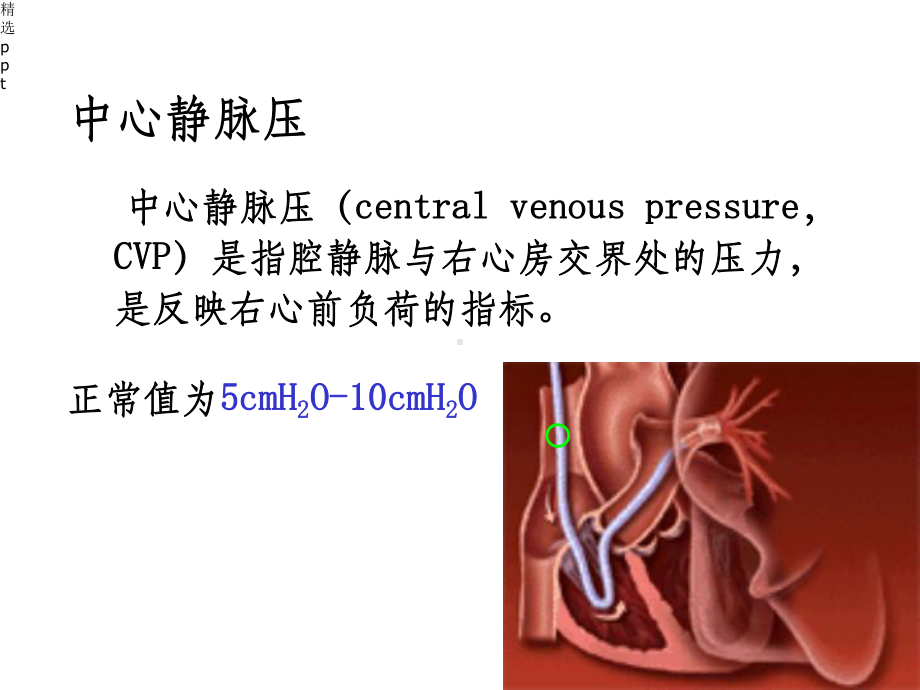 中心静脉压监测课件.ppt_第3页