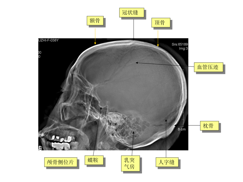 中枢神经系统医学影像学本科五年制第五版医学课件.ppt_第3页