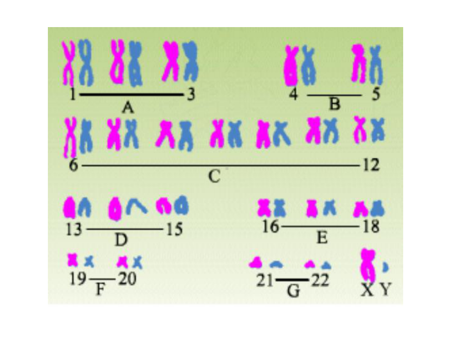 三体综合征浙教版课件.ppt_第3页