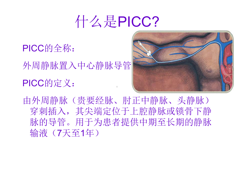 PICC置管术相关知识课件.ppt_第2页