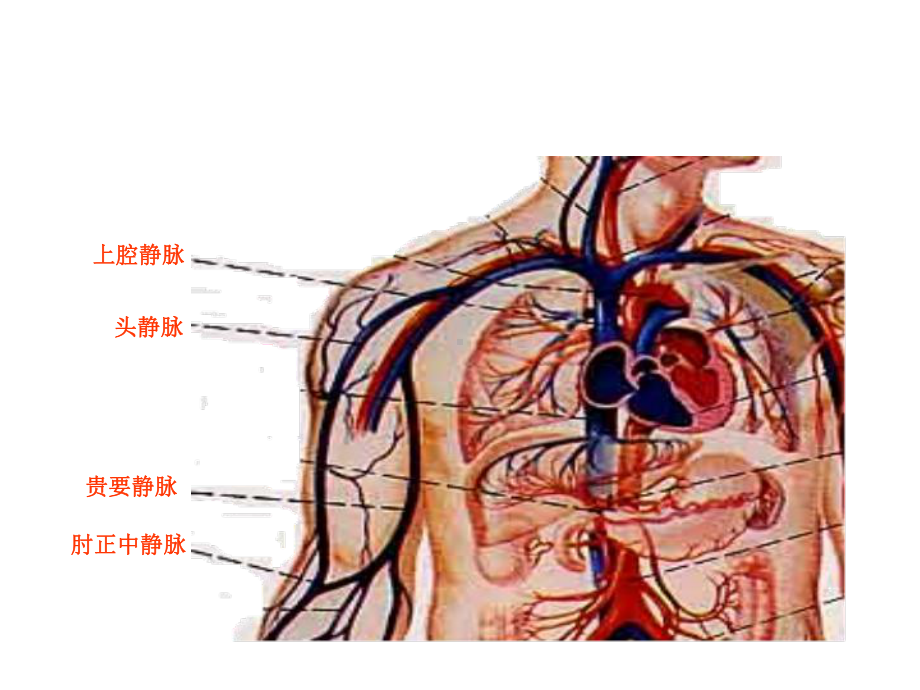 PICC置管术相关知识课件.ppt_第3页